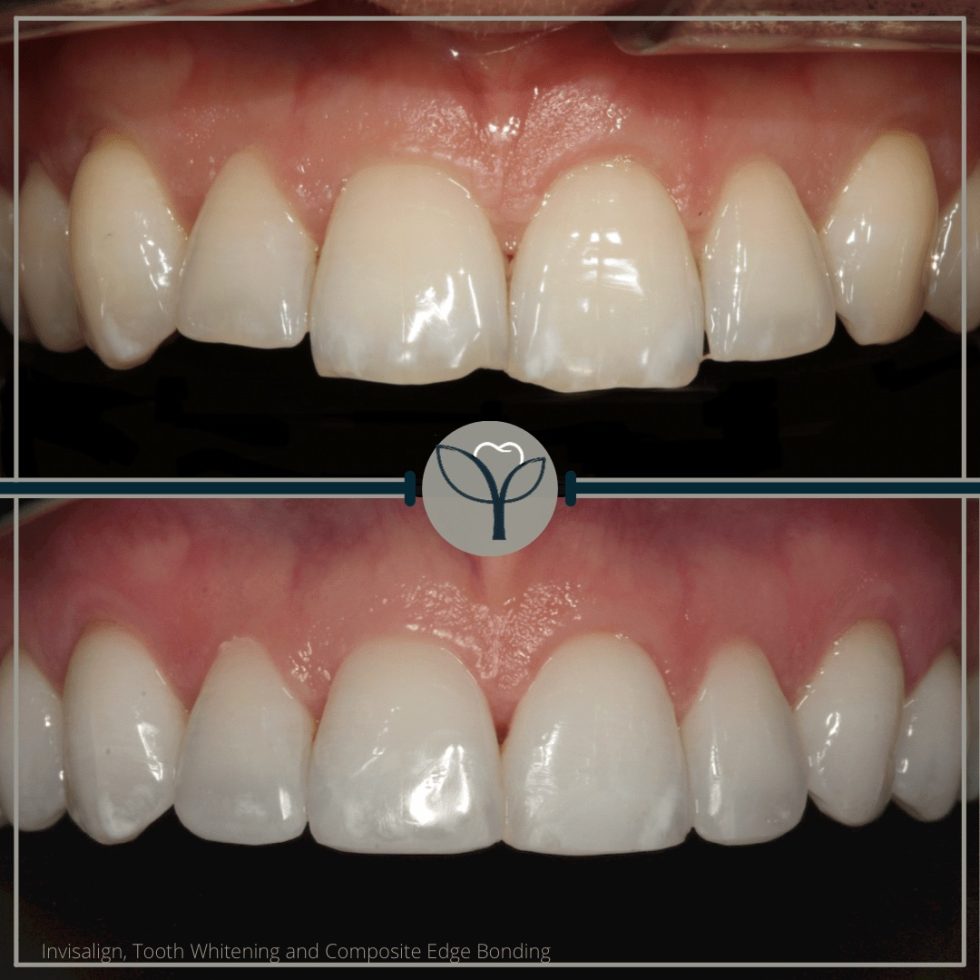 Smile Gallery Yor Dental Clinic In Salford Manchester