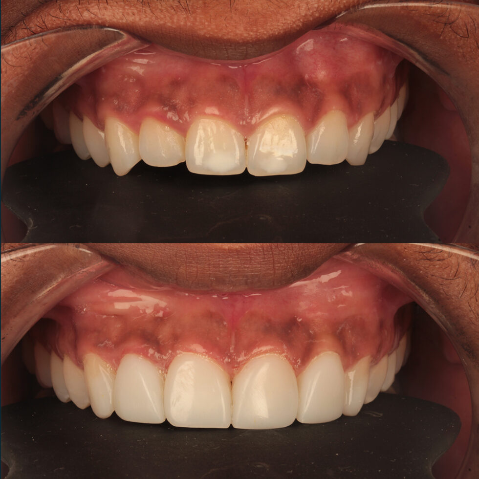 Salford Dentist Dentist Manchester Yor Dental Private Dentist